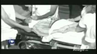 Lobotomy  PBS documentary on Walter Freemanmp4 [upl. by Haela961]