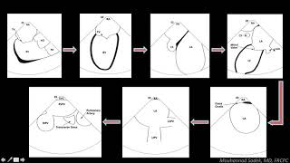 Intracardiac Echocardiography in EP Procedures  How can it help [upl. by Caffrey]