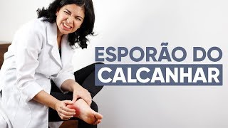 ESPORÃO NO CALCANHAR O que fazer [upl. by Jarita813]