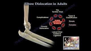 Elbow Dislocation In Adults  Everything You Need To Know  Dr Nabil Ebraheim [upl. by Gee149]