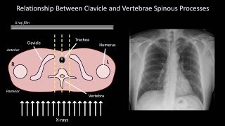 How to Interpret a Chest XRay Lesson 3  Assessing Technical Quality [upl. by Pearce]