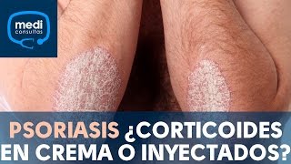 Psoriasis ¿corticoides en crema o inyectados MediConsultas [upl. by Osy]