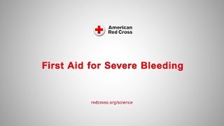 First Aid for Severe Bleeding [upl. by Judith817]