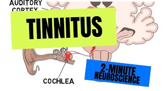 2Minute Neuroscience Tinnitus [upl. by Busch]