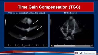 Basic Transthoracic Echocardiography Cardiac Ultrasound  TTE Made Simple [upl. by Nanaj]