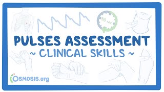 Clinical Skills Pulses assessment [upl. by Sudhir]