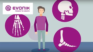 Biomaterials for Medical Devices  Evonik [upl. by Kieffer368]