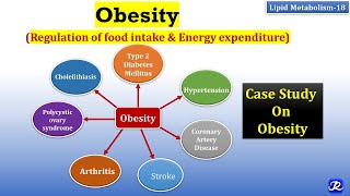 Obesity Health Risks or How Excessive Fat Destroys the Body [upl. by Nylirret343]