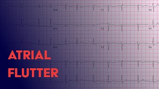 Atrial Flutter  EKG ECG Interpretation [upl. by Las]