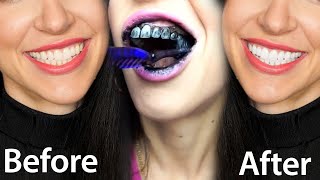 Fastest Way To Whiten Teeth At Home What REALLY Works [upl. by Ennayelsel]